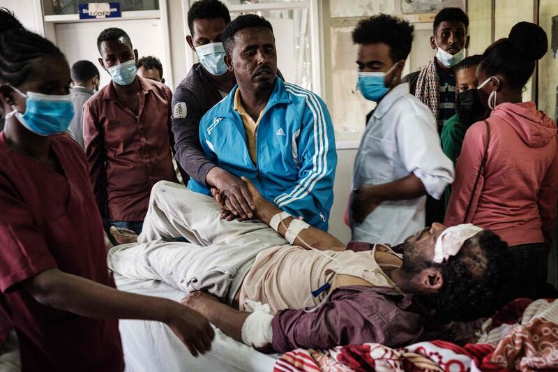 EDITORS NOTE: Graphic content / A Togoga injured resident, a village about 20km west of Mekele, where an alleged airstrike hit a market leaving an unknown number of casualties, moves on a stretcher for medical treatments at the Ayder referral hospital in Mekele, the capital of Tigray region, Ethiopia, on June 23, 2021. Witnesses and medical personnel said dozens were killed or wounded at a busy market in Togoga town on June 22, 2021, as ballot counting was underway across much of the rest of the country following June 21's national election. / AFP / Yasuyoshi CHIBA
