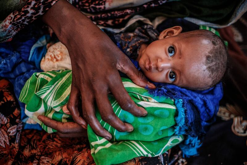 According to the UN children's agency Unicef, almost two million children across Ethiopia, Kenya and Somalia require urgent treatment for severe acute malnutrition, the deadliest form of hunger