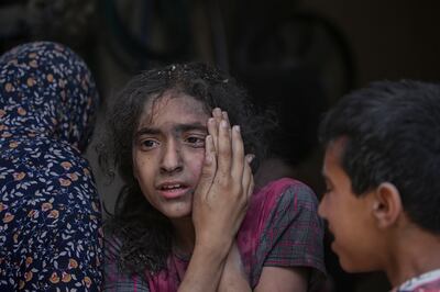 A young girl injured by an Israeli air strike on Al Nuseirat refugee camp in central Gaza. EPA