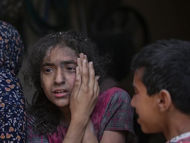 An injured Palestinian girl reacts following an Israeli air strike in Al Nuseirat refugee camp, central Gaza Strip, 29 April 2024.  More than 34,300 Palestinians and over 1,455 Israelis have been killed, according to the Palestinian Health Ministry and the Israel Defense Forces (IDF), since Hamas militants launched an attack against Israel from the Gaza Strip on 07 October 2023, and the Israeli operations in Gaza and the West Bank which followed it.   EPA / MOHAMMED SABER
