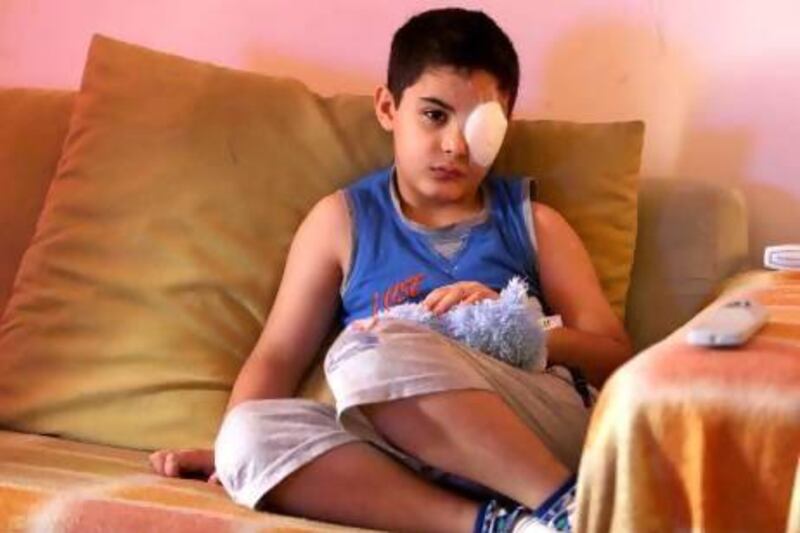 Yousef ben Lafi, 6, at his home in Ajman after his left eye was damaged when hand sanitiser squirted into it. Pawan Singh / The National