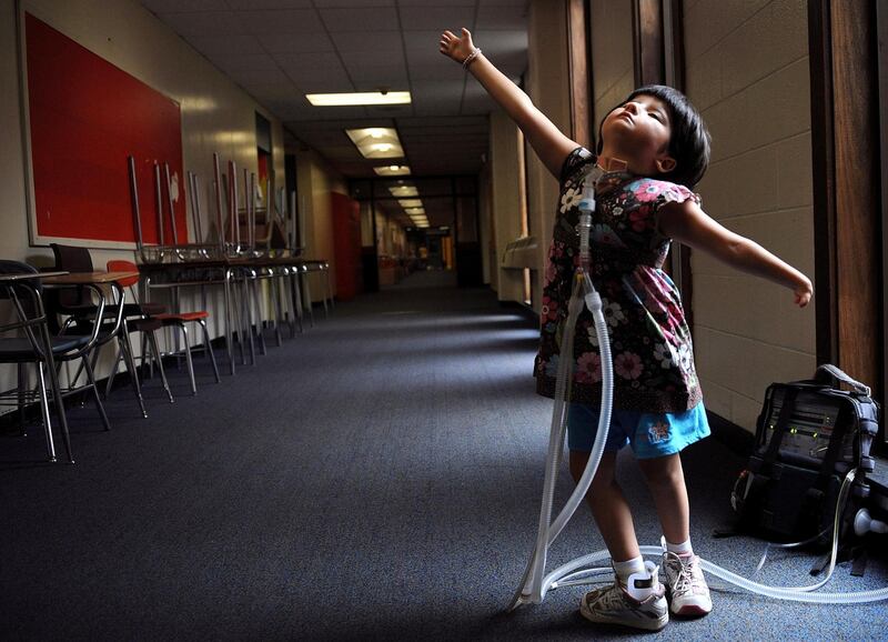 In an image by Essdras M Suarez, Jessica Leahey, 6, of Newton, Massachusetts, shows off a ballet move she’d just learnt at summer camp. Jessica has Mobius Syndrome, which is known as the mask disease, because those afflicted have no control over their facial muscles. Courtesy Xposure 2018