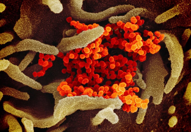This image provided by The National Institute of Allergy and Infectious Diseases (NIAID). This scanning electron microscope image shows SARS-CoV-2 (orange)â€”also known as 2019-nCoV, the virus that causes COVID-19â€”isolated from a patient in the U.S., emerging from the surface of cells (green) cultured in the lab. (NIAID-RML via AP)