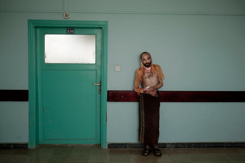 Monir Al Sharqi disappeared for a year and some in his family and other activists believe he was detained and tortured by Yemen’s Houthi rebels, who finally doused him with acid and dumped him in a stream. All photos by Nariman El-Mofty / AP Photo