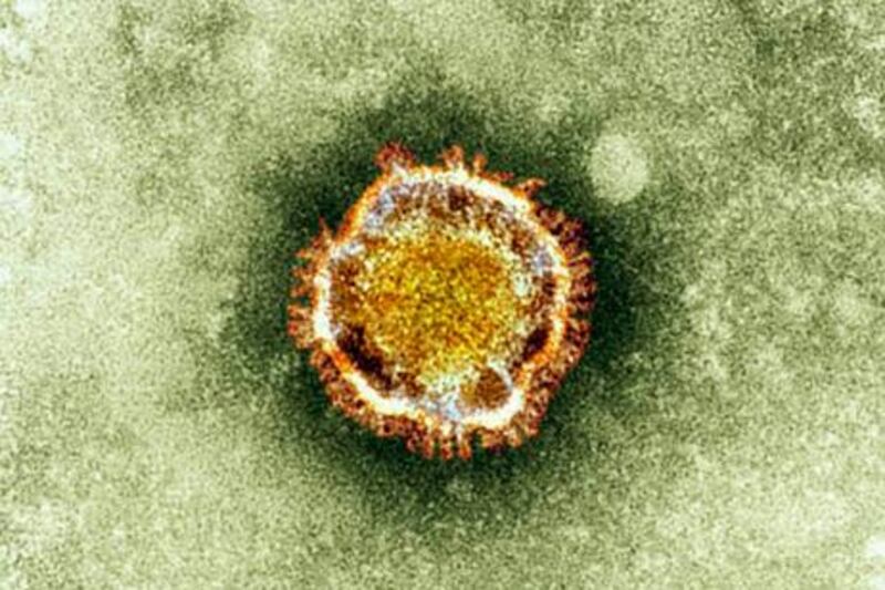 A SARS coronavirus is seen in this undated handout photograph released in London September 28, 2012. A new and potentially fatal virus from the same family as SARS which was discovered in a patient in London last week appears not to spread easily form person to person, the World Health Organisation (WHO) said on Friday. Professor Maria Zambon's first thought when her team of scientists matched a virus from a patient's sputum to one never before seen in humans was: "Oh no, this is going to be tricky." REUTERS/Health Protection Agency/Handout    (BRITAIN - Tags: HEALTH) NO COMMERCIAL OR BOOK SALES. NO SALES. NO ARCHIVES. FOR EDITORIAL USE ONLY. NOT FOR SALE FOR MARKETING OR ADVERTISING CAMPAIGNS. THIS IMAGE HAS BEEN SUPPLIED BY A THIRD PARTY. IT IS DISTRIBUTED, EXACTLY AS RECEIVED BY REUTERS, AS A SERVICE TO CLIENTS