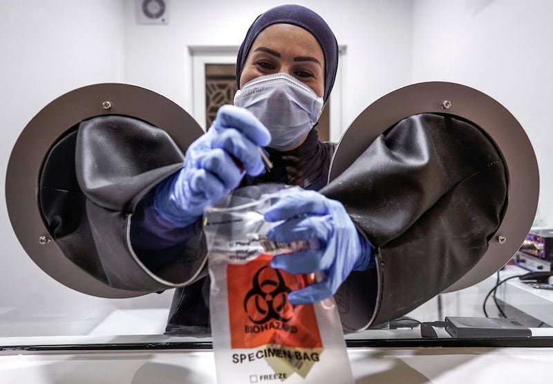 Abu Dhabi, United Arab Emirates, May 6, 2020. the new Ambulatory Healthcare Services, a SEHA Health System Facility, National Screening Project in Mussafah Industrial Area in Abu Dhabi.  --  A medical worker with a swab testing kit.Victor Besa / The NationalSection:  NAReporter:  Nick Webster