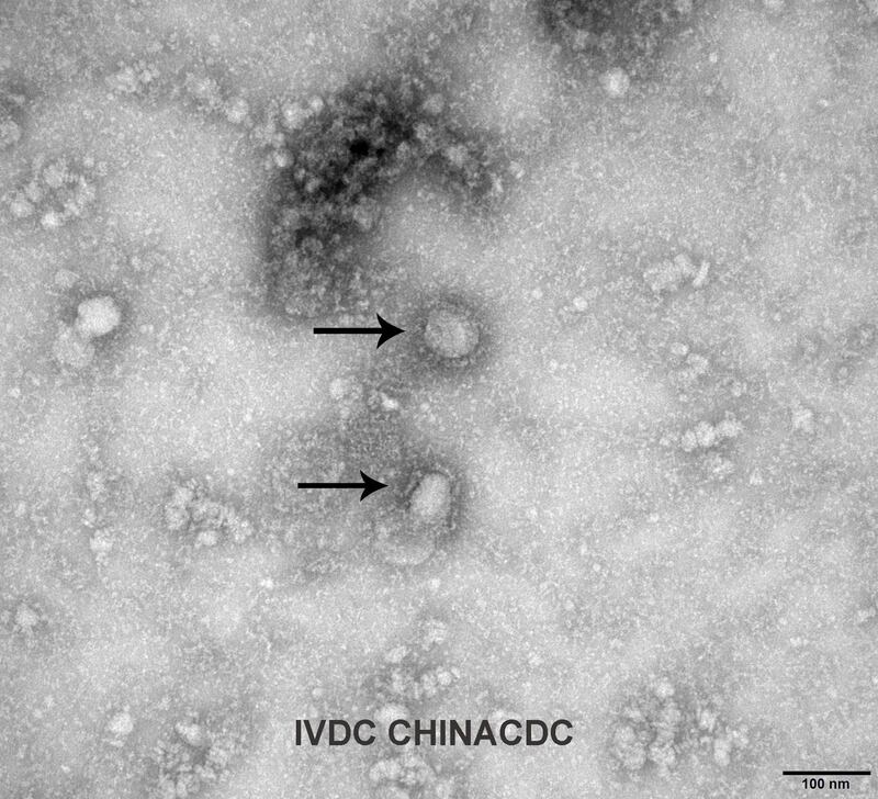 A Transmission Electron Microscopy image of the first isolated case of the coronavirus. Reuters
