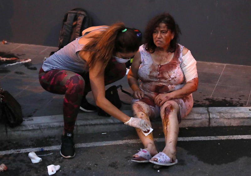 Wounded people wait to receive treatment outside a hospital following an explosion near the Beirut port. AFP