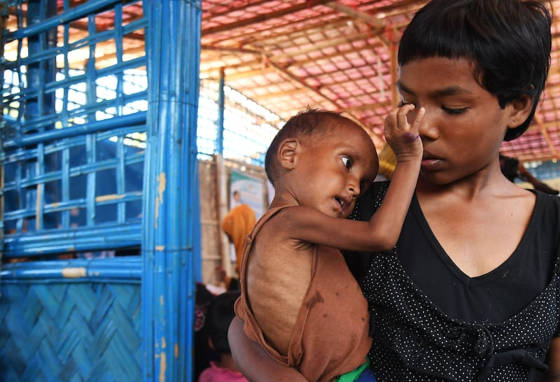 TOPSHOT - Zahid Hasan, the 1.5 years old Rohingya Muslim refugee with her sister waits to see a doctor to receive treatment for severe malnutrition at the Balukhali refugee camp in Bangladesh's Ukhia district on November 6, 2017. 
More than 600,000 Rohingya have fled to Bangladesh since late August carrying accounts of murder, rape and arson at the hands of Myanmar's powerful army during a military crackdown dubbed as "ethnic cleansing" by the UN. / AFP PHOTO / Dibyangshu SARKAR