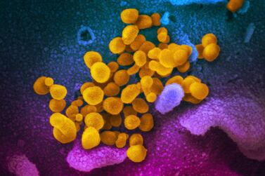 A microscope image of the Novel Coronavirus SARS-CoV-2 (yellow) emerging from the surface of cells, blue/pink, cultured in a lab. NIAID-RML via AP