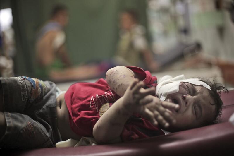 A boy cries while receiving treatment for injuries. Khalil Hamra / AP Photo
