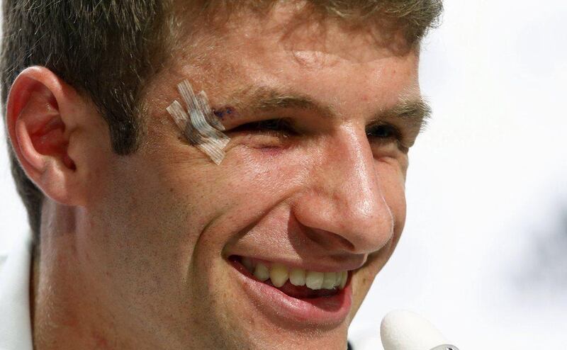 Thomas Muller shown with a cut by his right eye during a press conference on Tuesday ahead of Germany's Thursday match with the United States at the 2014 World Cup in Brazil. Arnd Wiegmann / Reuters / June 24, 2014