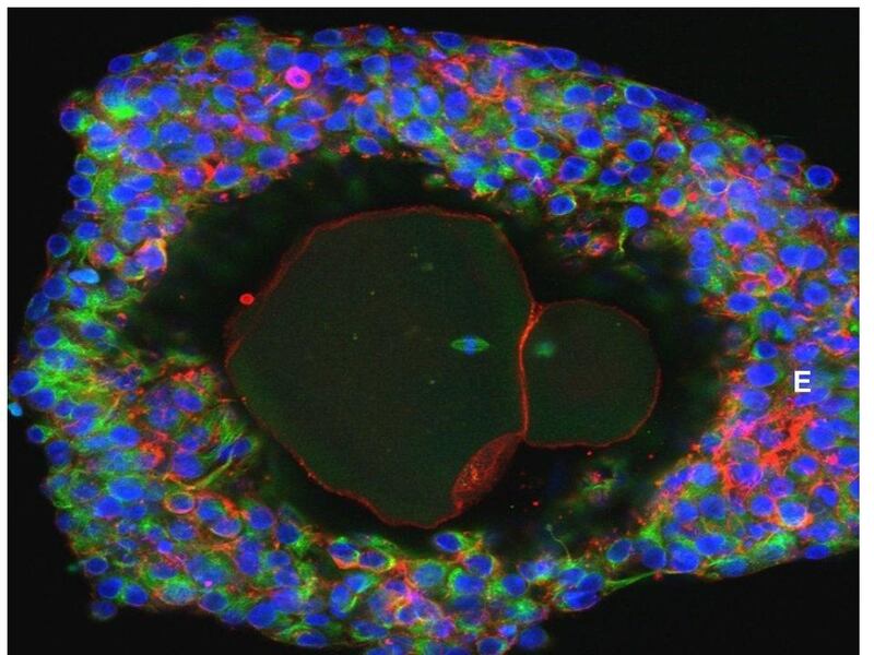 A magnification of a fully matured human egg ready for fertilisation. Professor David Albertini