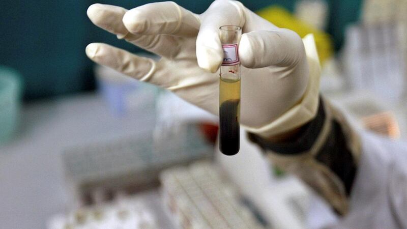 A laboratory assistant examines a blood sample. Courtesy:Reuters      