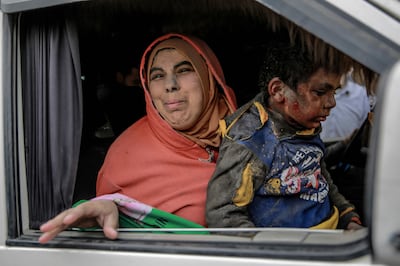 Wounded Palestinians in a car on Monday as they wait to be evacuated after Israeli bombardment in central Gaza city. AFP