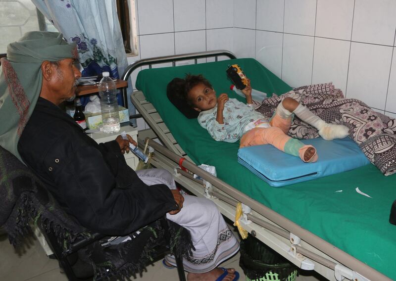 A Yemeni child wounded in ongoing fighting lies on a bed at a hospital in Taez city on February 13, 2016. EPA