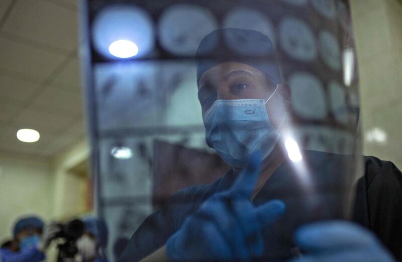 A medical staffer wearing protective gear inspects chest X-ray scans at Basra University Hospital, where Covid-19 coronavirus patients are treated, in the southern Iraqi city.   AFP