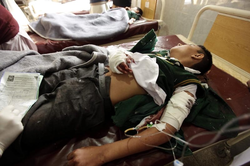 A schoolboy who was injured in a Taliban attack receives medical treatment at a hospital in Peshawar.  Arshad Arbab / EPA