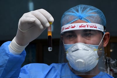 An Iraqi phlebotomist holds a test tube containing a blood sample of a recovered COVID-19 patient at the blood bank of Iraq's southern city of Nasiriyah in Dhi Qar province, on June 24, 2020.  / AFP / Asaad NIAZI
