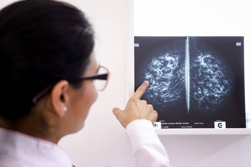 AI-assisted screenings could reduce workload for radiologists and speed up diagnosis, researchers found. EPA