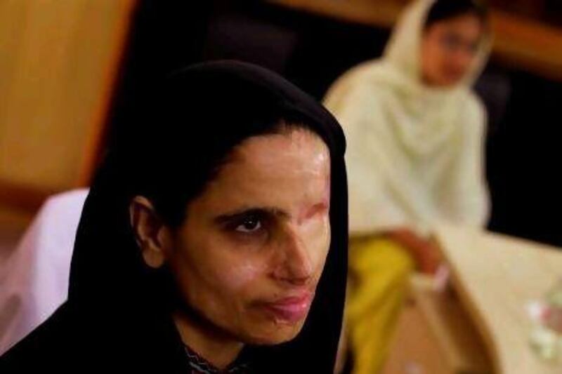 Zakia, an acid attack survivor, fears the backlash the film could bring at home.