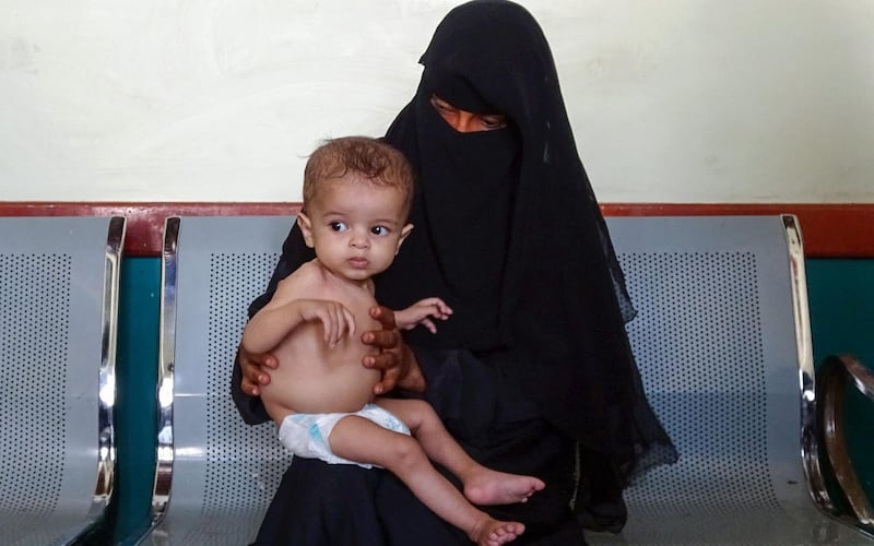 A Yemeni woman waits with her malnourished child ahead of treatment sessions at a medical center in the war-ravaged western province of Hodeida, on May 1, 2021. / AFP / Khaled Ziad
