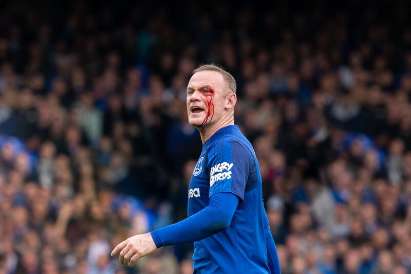 Wayne Rooney suffers an eye injury whilst playing for Everton against Bournemouth. 03/09/2017. Emma Simpson / FPA / LDY Agency