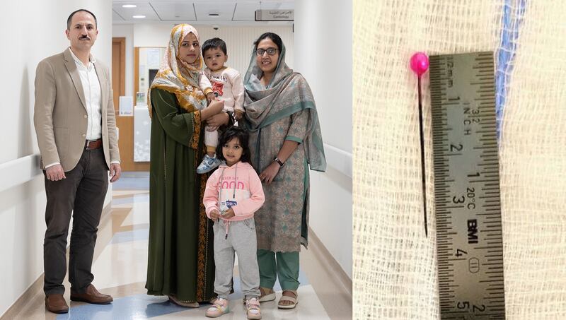 The pin, right, swallowed by Dewan Ahmad, pictured left with his mother and the doctors who saved his life, Dr Suni Akbar, right, and Dr Khaldoon Dakka, left. Photo: Zulekha Hospital