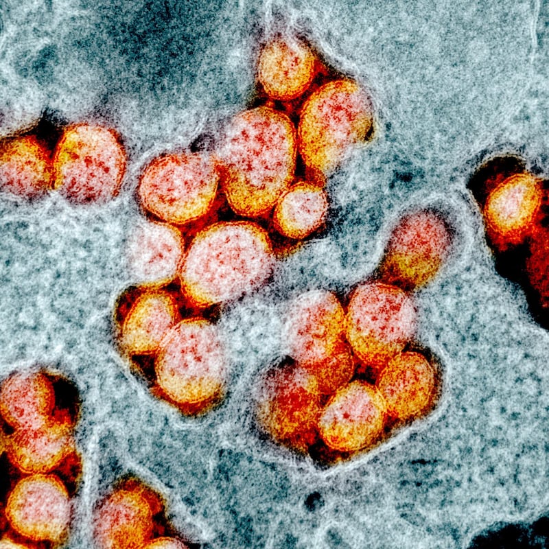 Image made available by the National Institutes of Health (NIH) shows a transmission electron micrograph of SARS-CoV-2 virus particles, also known as 2019-nCoV, the virus that causes Covid-19, isolated from a patient.  EPA
