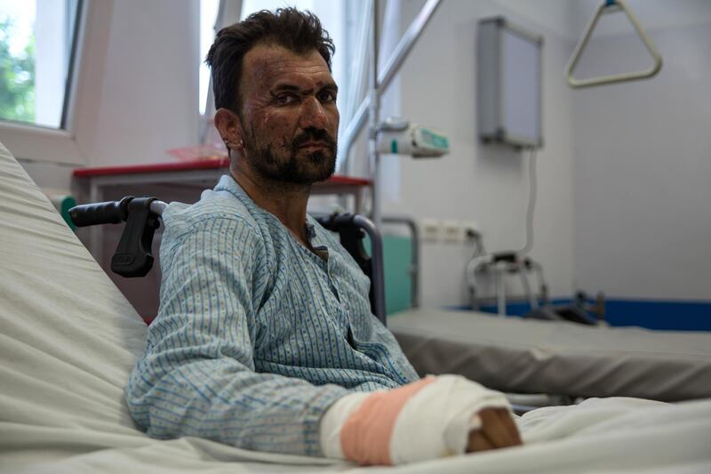 Abdul Wahad, 41, lost his leg in an explosion targeting a bus transporting government workers. 