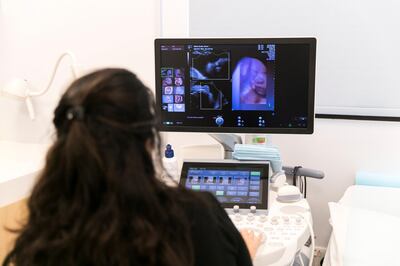 ABU DHABI, UNITED ARAB EMIRATES - OCT 5:

 Dr. Leanne Bricker, Corniche Hospital���s Chair of Fetal Medicine, looks at healthy child's 3d image scan.

(Photo by Reem Mohammed/The National)

Reporter: Shireena Al Nuwais
Section: NA