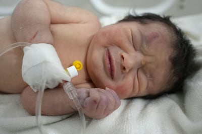 The newborn baby who was found still tied by her umbilical cord to her mother. AFP