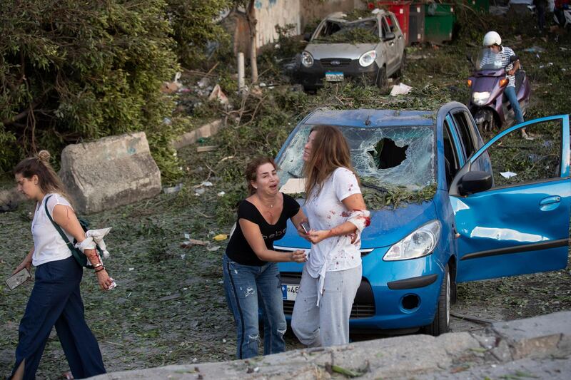 Injured people stand after the explosion. AP Photo