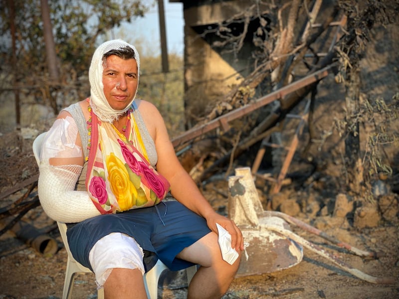 An injured woman sits in front of a burnt house after a massive bushfire engulfed a Mediterranean resort region on Turkey's southern coast, near the town of Manavgat.