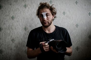 24-year-old Syrian freelance photographer Ameer Al Halbi was injured during clashes in a demonstration against the 'global security' draft law in Paris. AFP