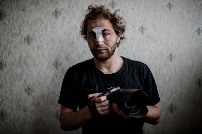 24-year-old Syrian freelance photographer Ameer al-Halbi, injured during clashes in a demonstration against the 'global security' draft law, poses with his camera at home in Paris, on November 29, 2020. Award-winning Syrian photojournalist wounded in a Paris protest against police brutality said on November 29 he had suffered a "heavy shock" and the experience had reawoken memories from the civil war in his home country. Ameer al-Halbi, said after being hurt in the protests the day before, that he was trapped for several hours with head wounds unable to get to hospital. A police source said on November 29 an internal administrative inquiry has been opened to determine the circumstances under which al-Halbi was hurt in the protests. / AFP / Sameer Al-DOUMY
