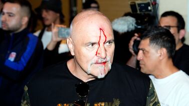 **EDITOR NOTE: Blood shown** John Fury, father of boxer Tyson Fury, with blood on his face during a media day in Riyagh. The IBF, WBA, WBC and WBO heavyweight title fight between Tyson Fury v Oleksandr Usyk will take place on Saturday 18th May. Picture date: Monday May 13, 2024. PA Photo. See PA story BOXING Fury. Photo credit should read: Nick Potts/PA Wire.

RESTRICTIONS: Use subject to restrictions. Editorial use only, no commercial use without prior consent from rights holder.