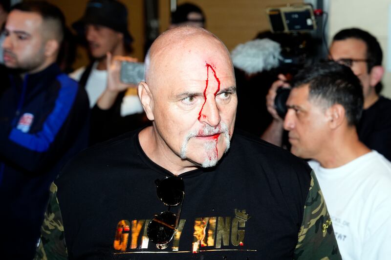 John Fury, father of WBC heavyweight champion Tyson Fury, with blood on his face during a media day in Riyadh. John suffered the cut after headbutting a member of Oleksandr Usyk's entourage, his son's opponent in Saudi Arabia on Saturday in a unification bout. PA