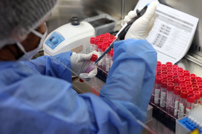 Lab staff working in the sample preparation room at Dubai Airport (DXB). All photos: Pawan Singh / The National