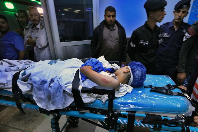 An injured pupil lays on a stretcher at a hospital in Jordan. AFP