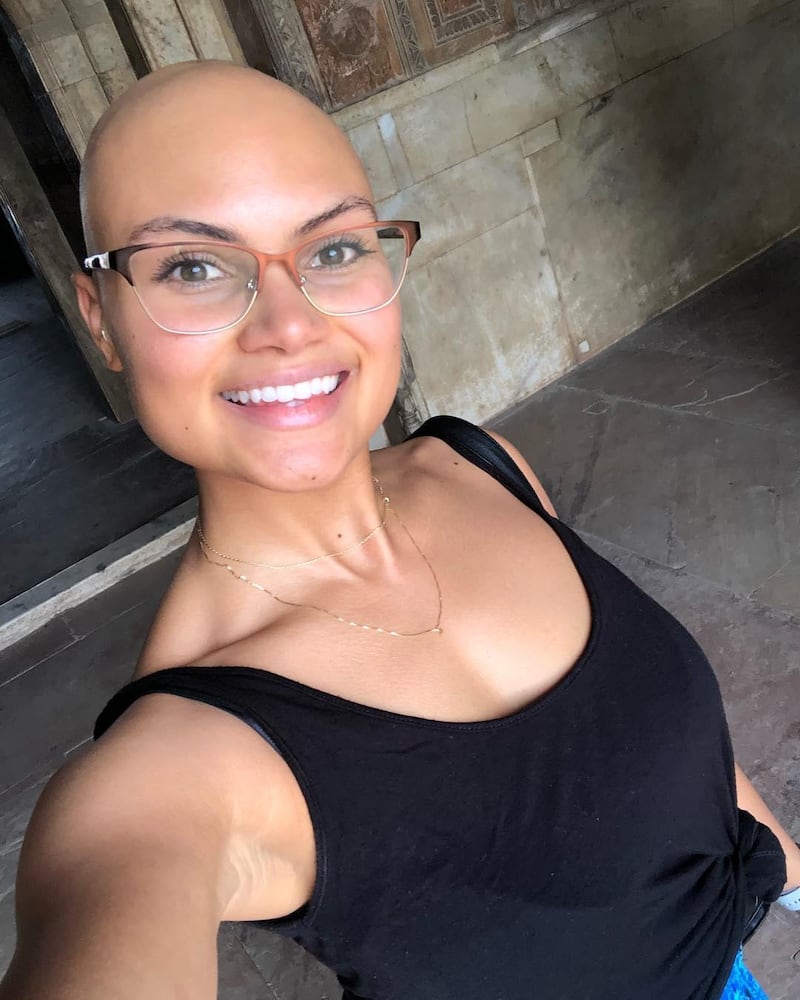 Yasmin Taylor says social media helped her embrace her bald head and inspired others to do so, too. Yasmin Taylor / Instagram 