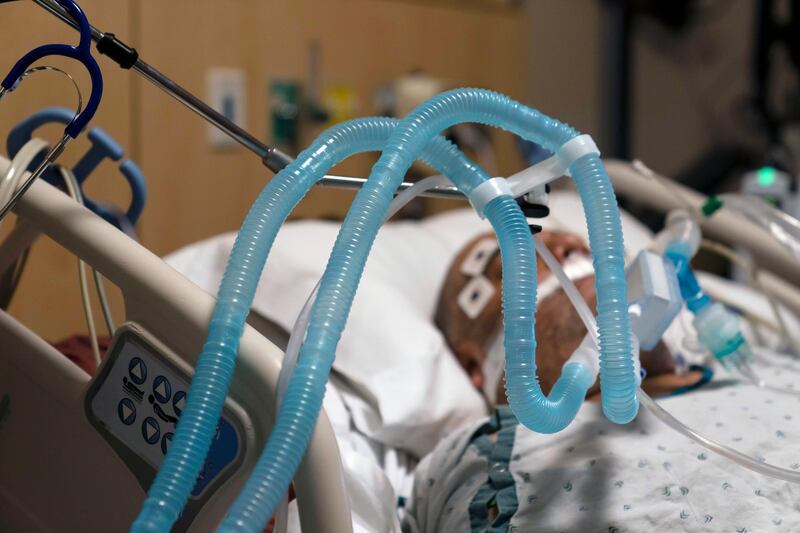 Ventilator tubes are attached to a Covid-19 patient at Providence Holy Cross Medical Center in the Mission Hills section of Los Angeles, California. AP Photo