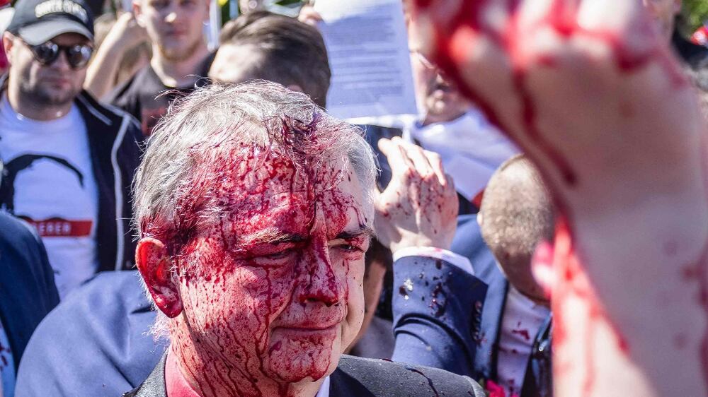 Russian ambassador hit with red paint at Ukraine protest
