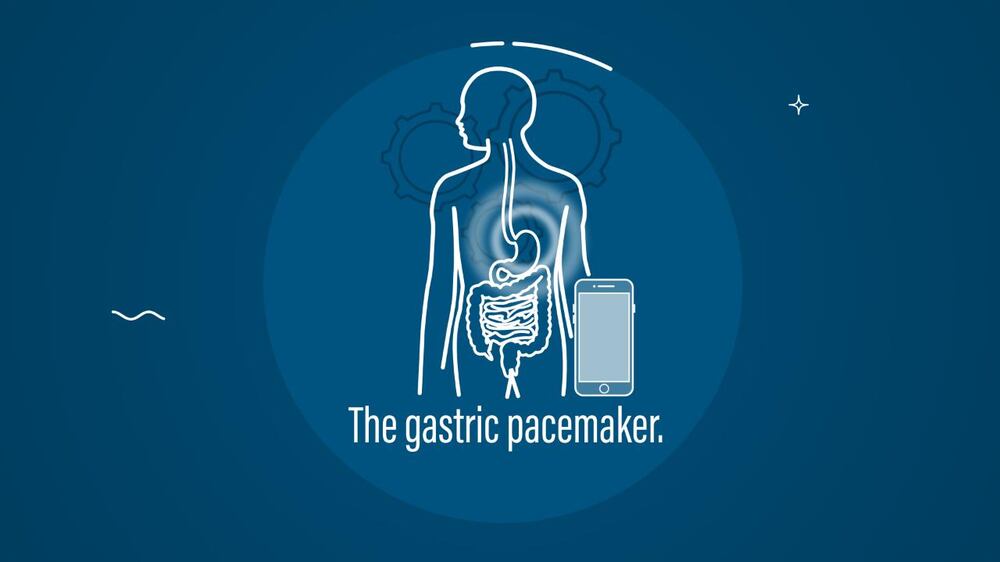 What is the gastric pacemaker?