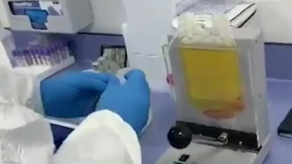 Abu Dhabi Stem Cells Centre develops coronavirus treatment