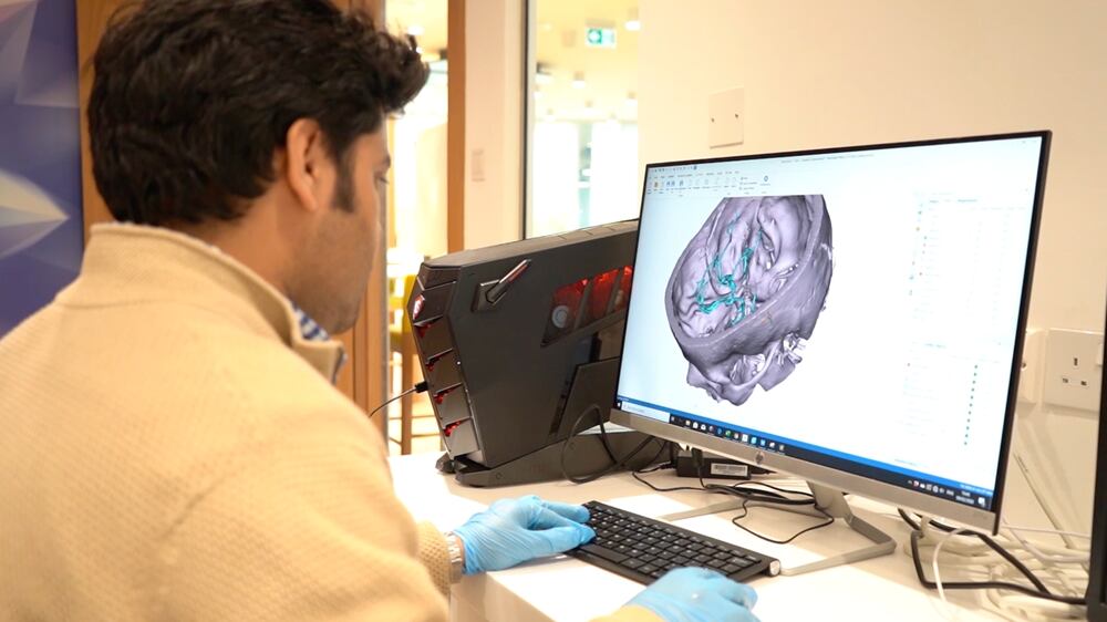 How a Dubai company is 3D printing prosthetics to revolutionise healthcare