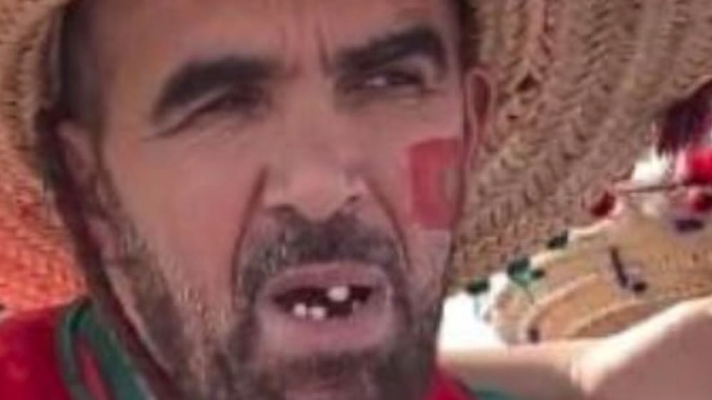 Dubai-based dentist gives Morocco football fan new smile