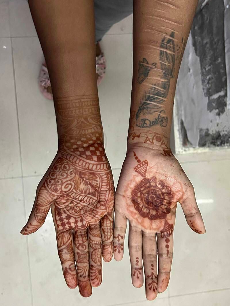 K shows her henna-painted hands. The 22 year old is undergoing treatment for drug abuse at Navjeevan Kendra in Kapurthala. 