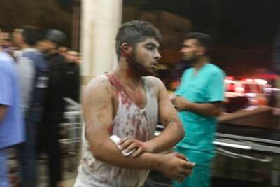 A wounded Palestinian man arrives at Nasser Medical Complex, following Israeli air strikes on the town of Khan Younis in the southern Gaza Strip. AP