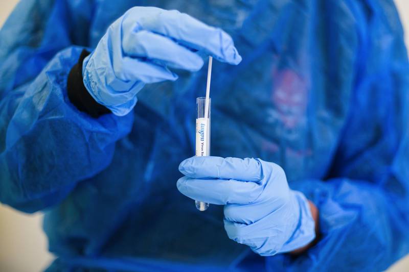 A health worker removes a swab test from a test tube at a Covid-19 test center in the 18th arrondissement in Paris, France, on Friday, Sept. 25, 2020. Germany, France and the U.K. are all reporting a surge in Covid-19 cases as Europe strains to control the resurgent pandemic. Photographer: Nathan Laine/Bloomberg